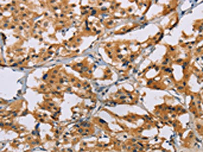 Anti-NRN1 Antibody