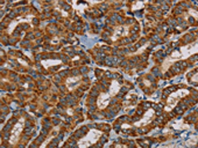 Anti-MRPL28 Antibody
