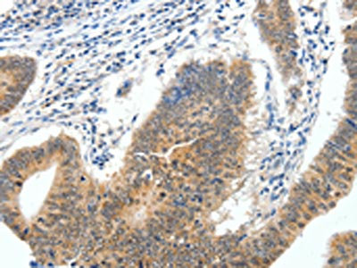 Anti-ECE2 / Endothelin converting enzyme 2 Antibody