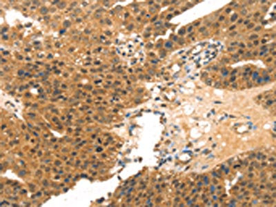 Anti-MED14 Antibody