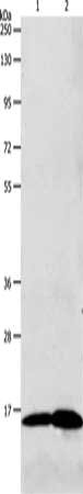 Anti-LHB Antibody