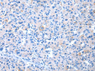 Anti-COLEC12 Antibody