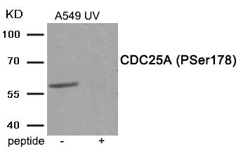 Anti-Phospho-CDC25A (Ser178) Antibody