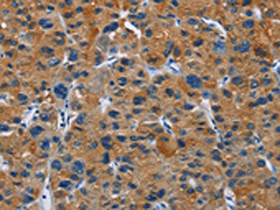 Anti-MSH5 Antibody