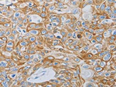 Anti-MC5R Antibody