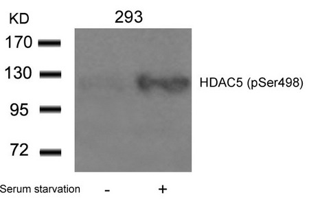Anti-Phospho-HDAC5 (Ser498) Antibody