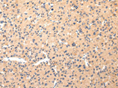 Anti-COL8A2 Antibody