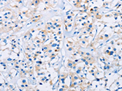 Anti-CD33 Antibody