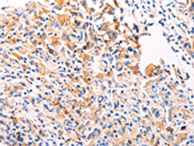 Anti-PGBD1 Antibody