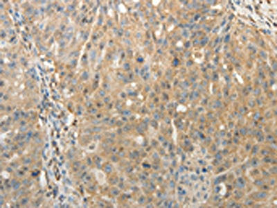 Anti-SULT1E1 / Sulfotransferase 1E1 Antibody
