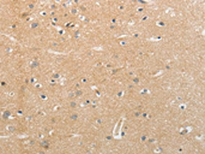 Anti-NFASC Antibody