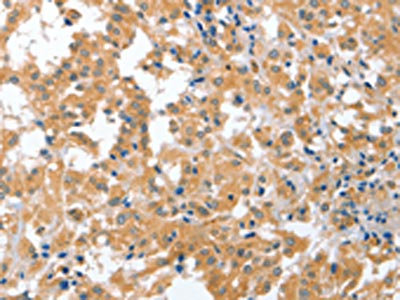 Anti-CDR2 Antibody