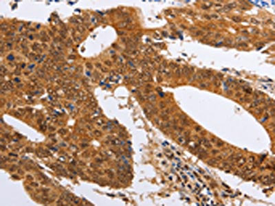 Anti-PSMD8 Antibody