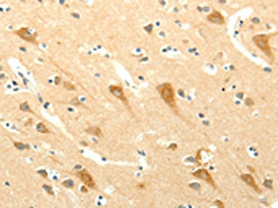 Anti-SYT5 / Synaptotagmin 5 Antibody