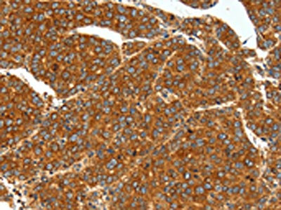 Anti-SSTR1 Antibody