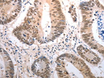 Anti-RAD50 Antibody