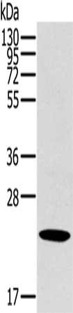 Anti-OTUB2 Antibody