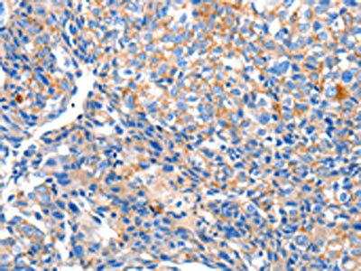 Anti-HCN2 Antibody