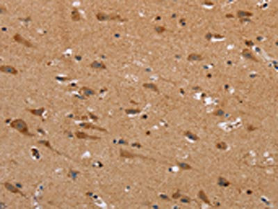 Anti-NDRG3 Antibody