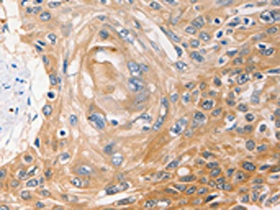 Anti-NME1 Antibody