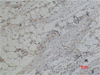 Anti-PRDX1 Antibody