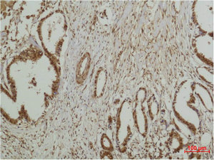 Anti-MAPK7 / ERK5 Antibody