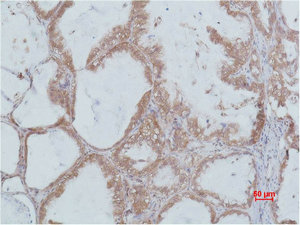 Anti-STAT2 Antibody