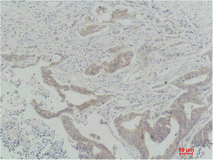 Anti-Raf1 Antibody