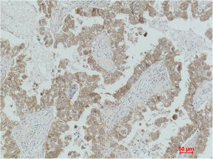 Anti-MAP2K2 / MEK2 Antibody