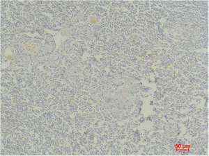 Anti-STAT4 Antibody