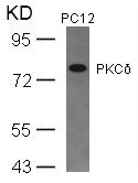Anti-PRKCD (Ab-645) Antibody