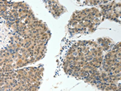 Anti-ROCK2 Antibody