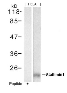 Anti-STMN1 (Ab-62) / Stathmin Antibody