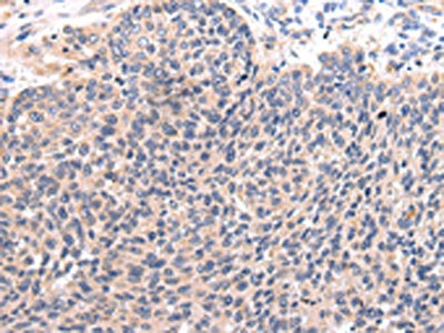 Anti-CCL7 / MCP-3 Antibody