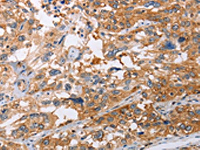Anti-NLRP3 Antibody
