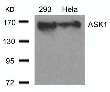 Anti-MAP3K5 (Ab-966) ASK1 Antibody