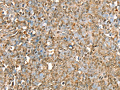 Anti-RBM5 Antibody