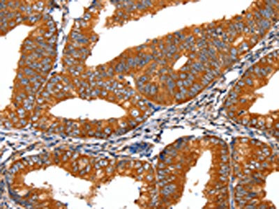 Anti-FGFR1/ CD331 Antibody