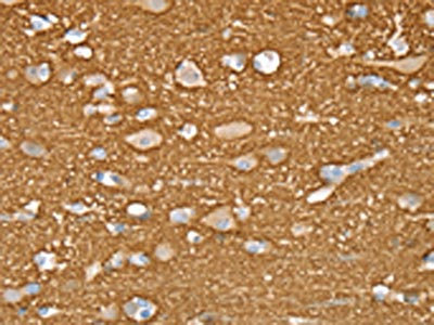 Anti-STXBP1 Syntaxin binding protein 1 (p67) Antibody