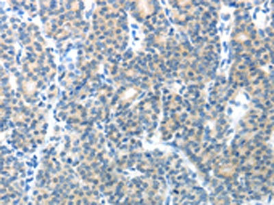 Anti-CEACAM1 Antibody