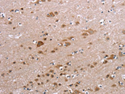 Anti-PPP2R3C Antibody