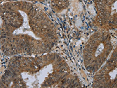 Anti-NAT10 Antibody