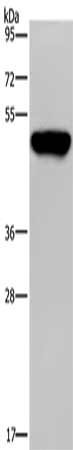 Anti-PSMD11 Antibody