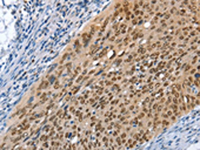Anti-MCM6 Antibody