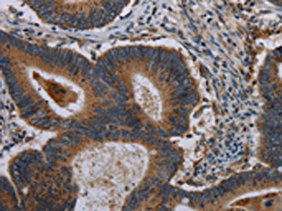 Anti-MAP3K11 Antibody