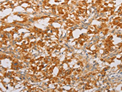 Anti-BNIP3 Antibody