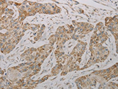 Anti-TAC1 / Protachykinin 1 Antibody