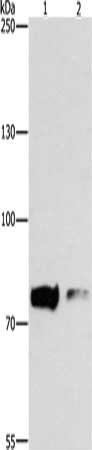 Anti-PRKCB Antibody