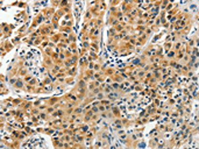 Anti-PFDN6 Antibody
