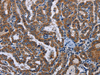 Anti-LYN Antibody